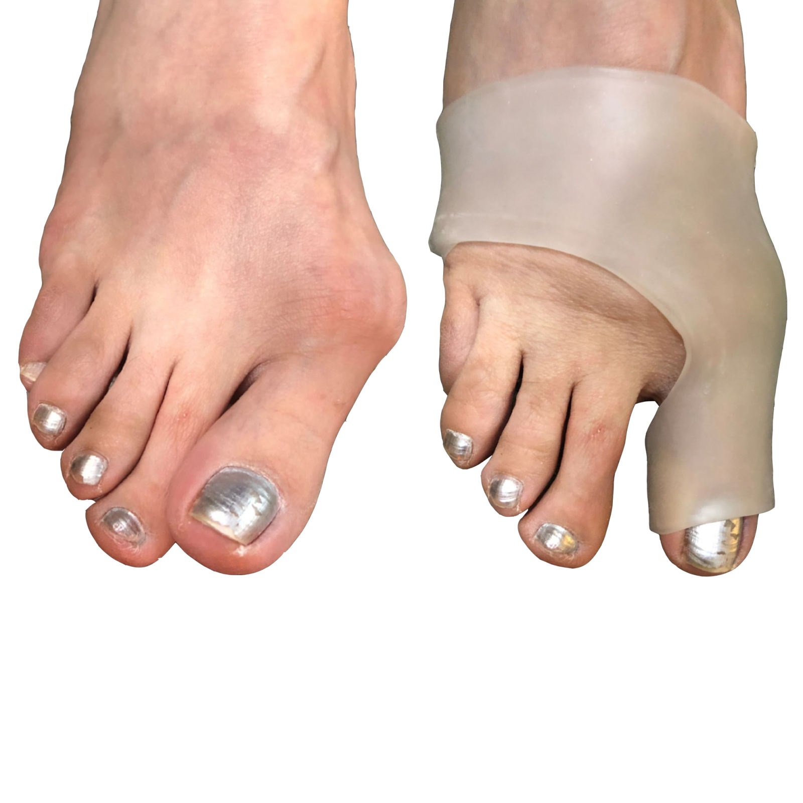 پد هالوکس والگوس مدل H1 بسته 2 عددی